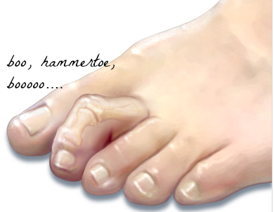 slippers for hammer toes