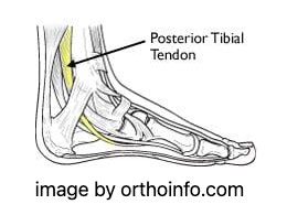 Barking Dog Shoes reviews and recommends the best footwear for people with various foot issues (as well as for women with average feet for whom comfort is a high priority).