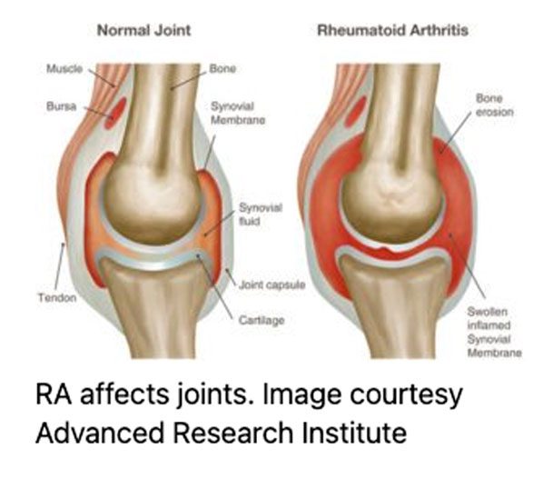 Barking Dog Shoes reviews and recommends the best footwear for people with various foot issues (as well as for women with average feet for whom comfort is a high priority).